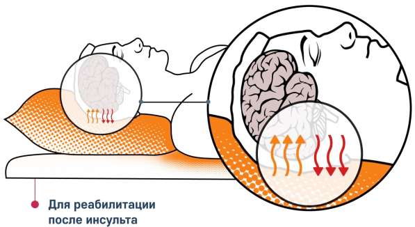 Мягкие модули с наполнителем из микросфер