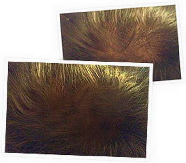Спрей для восстановления и роста волос Ultra Hair Spray Syst в Москве фото 4