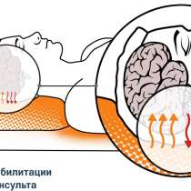 Мягкие модули с наполнителем из микросфер, в Твери